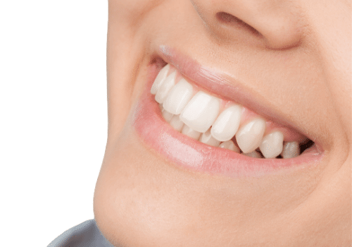Bright Smile, Dental House Melton