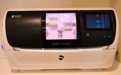 Same-Day Crowns: How In-House Technology Changes Dental Treatment