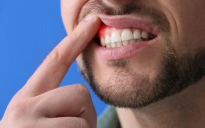 A Common Diabetes Drug For Treating Gum Disease