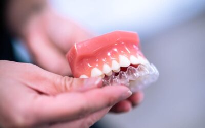 Your Braces Are Off, Now What? A Guide to Post-Orthodontic Retainers