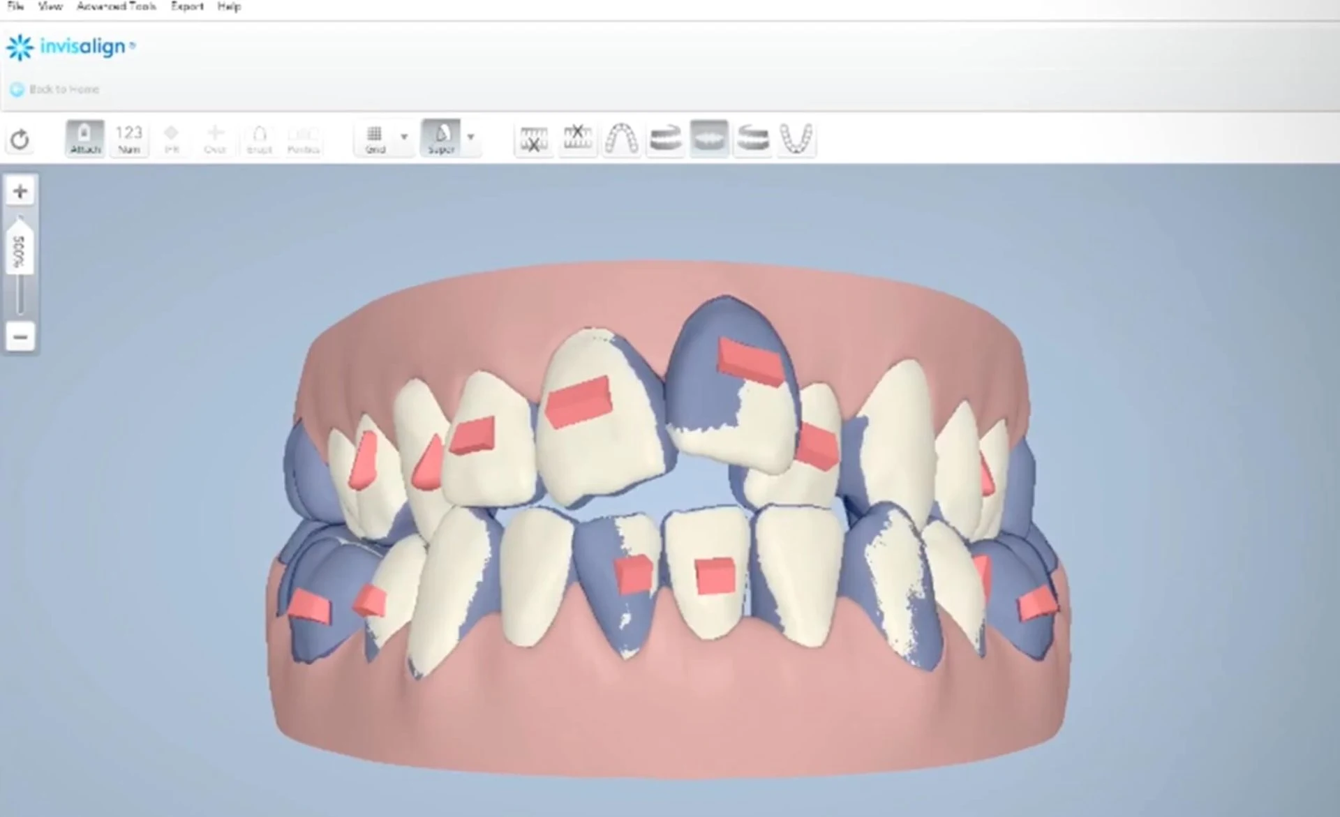 What Is The Cost Of Orthodontic Treatment? Aligners Melbourne Dental House Group 1