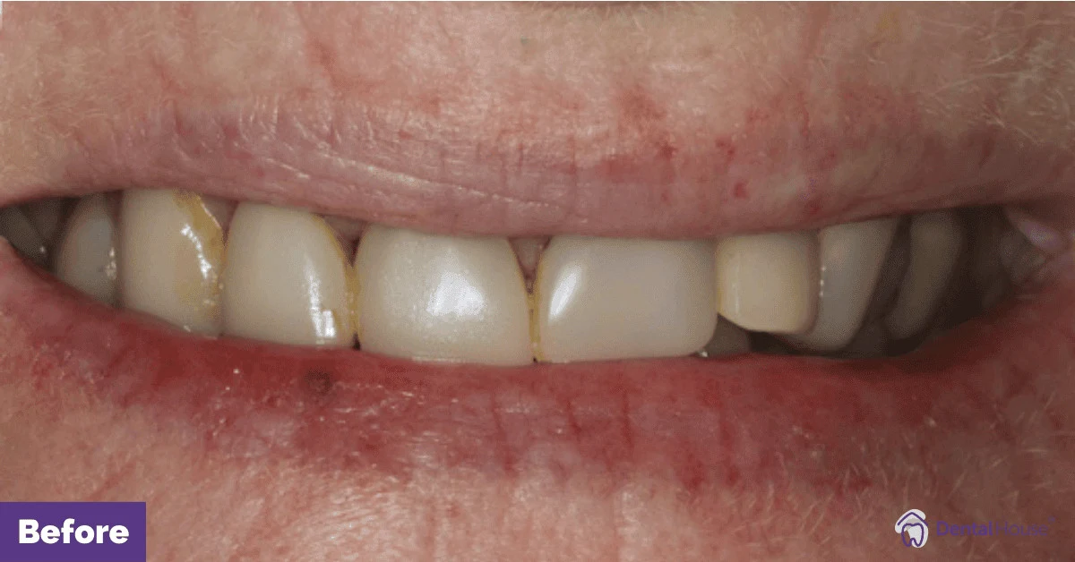 CP’s Smile Makeover in Gisborne Gallery image