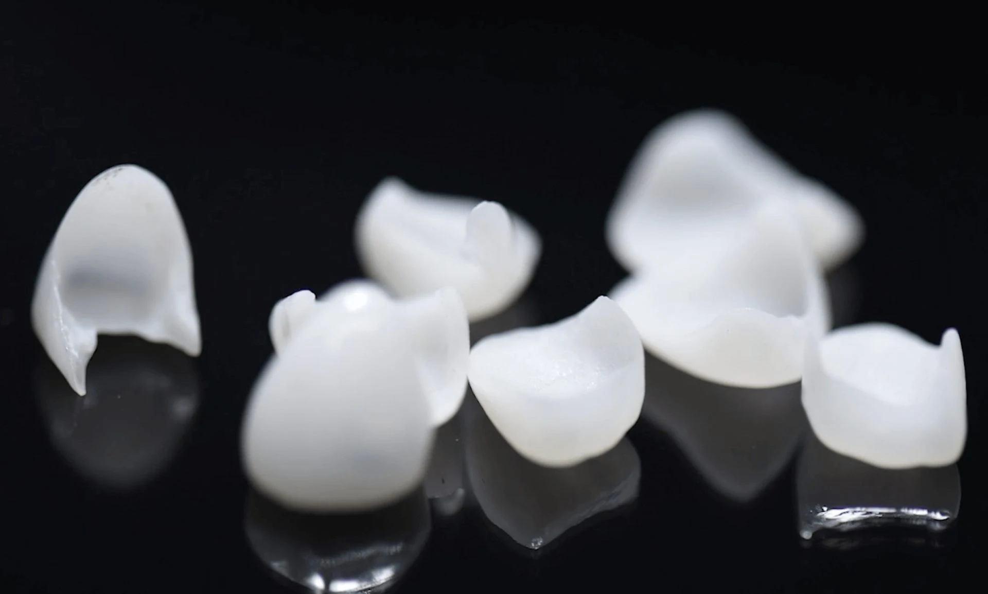What Is The Cost Of Dental Veneers? Dental House Group Dental Veneers 1