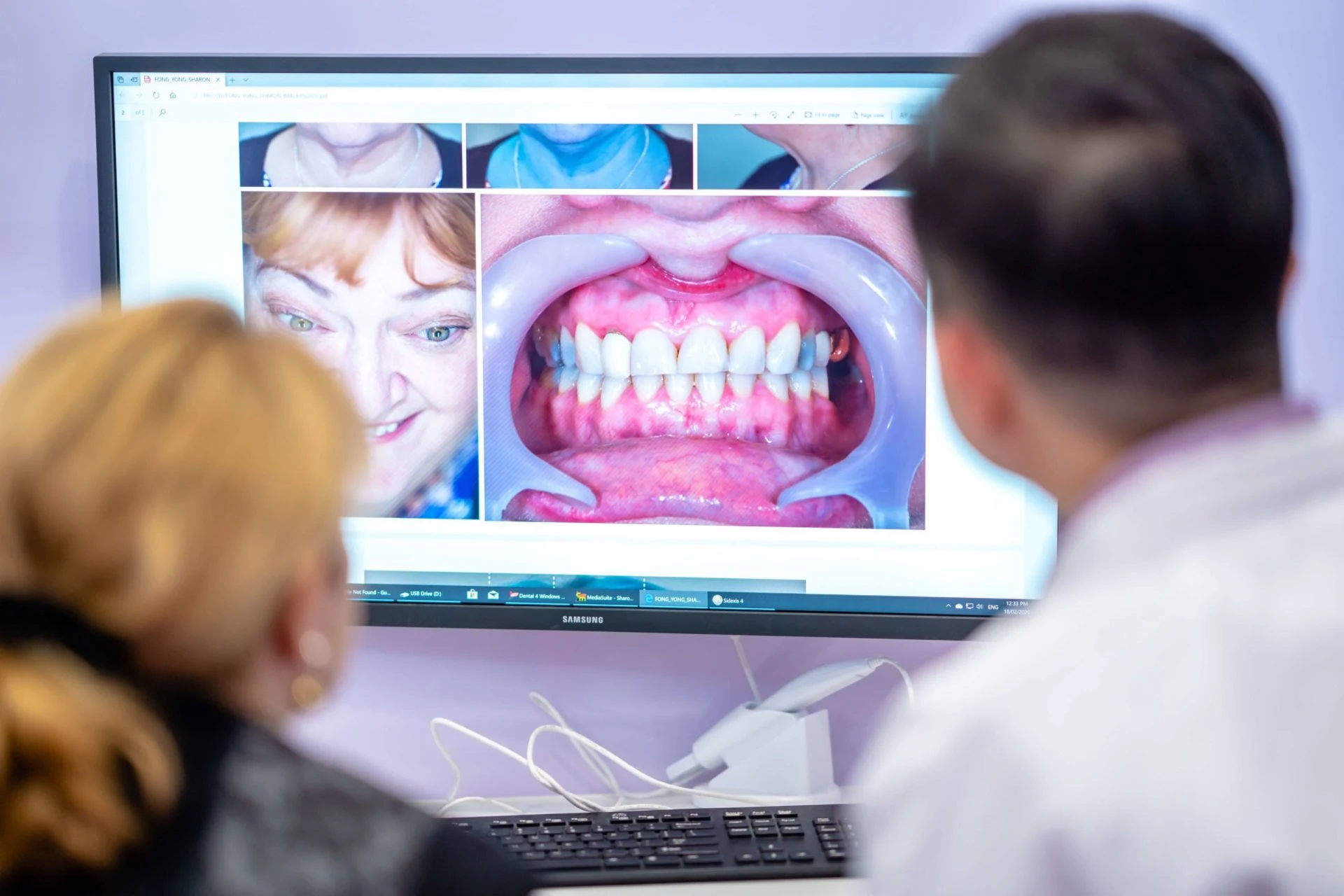 Top 3 Problems Dental Veneers Fix Dental House Veneers scaled 1 1