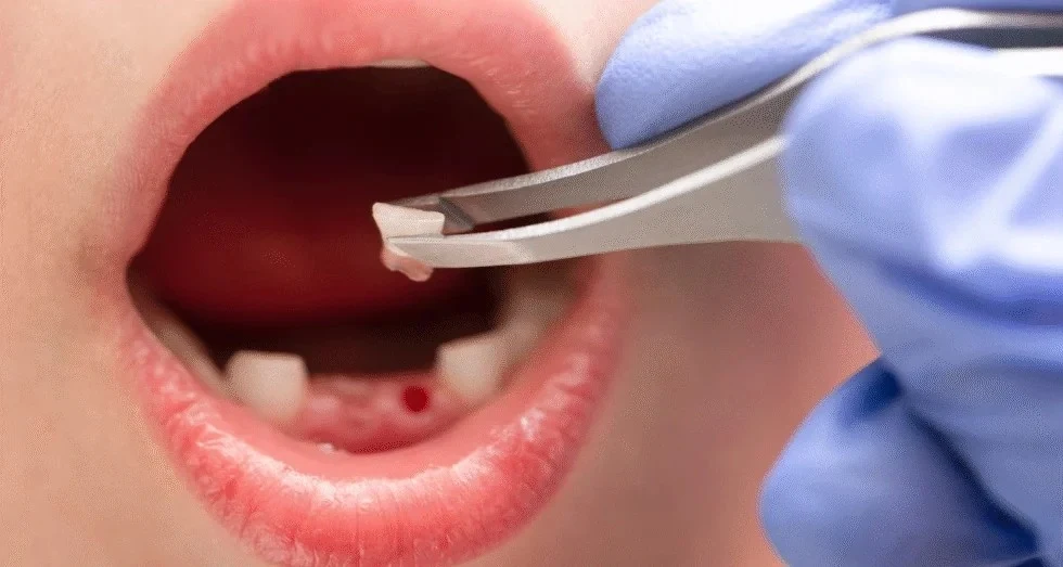From Playground Falls to Toothaches: Handling Your Child’s Dental Emergency From Playground Falls to Toothaches Handling Your Child’s Dental Emergency in Melton Dental House