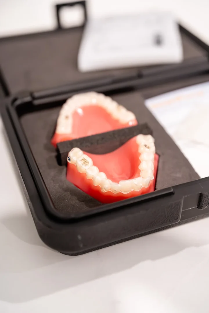Invisalign and Its Effectiveness Melton Dental House