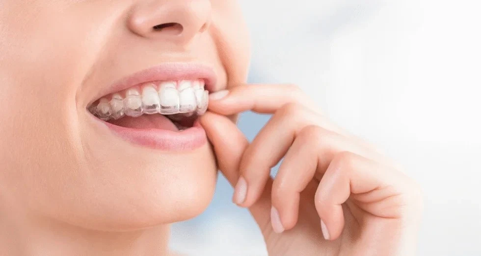 Invisalign for Crooked Teeth: Advanced Cosmetic Orthodontics in Melton Invisalign for Crooked Teeth Advanced Cosmetic Orthodontics in Melton in Melton Dental House