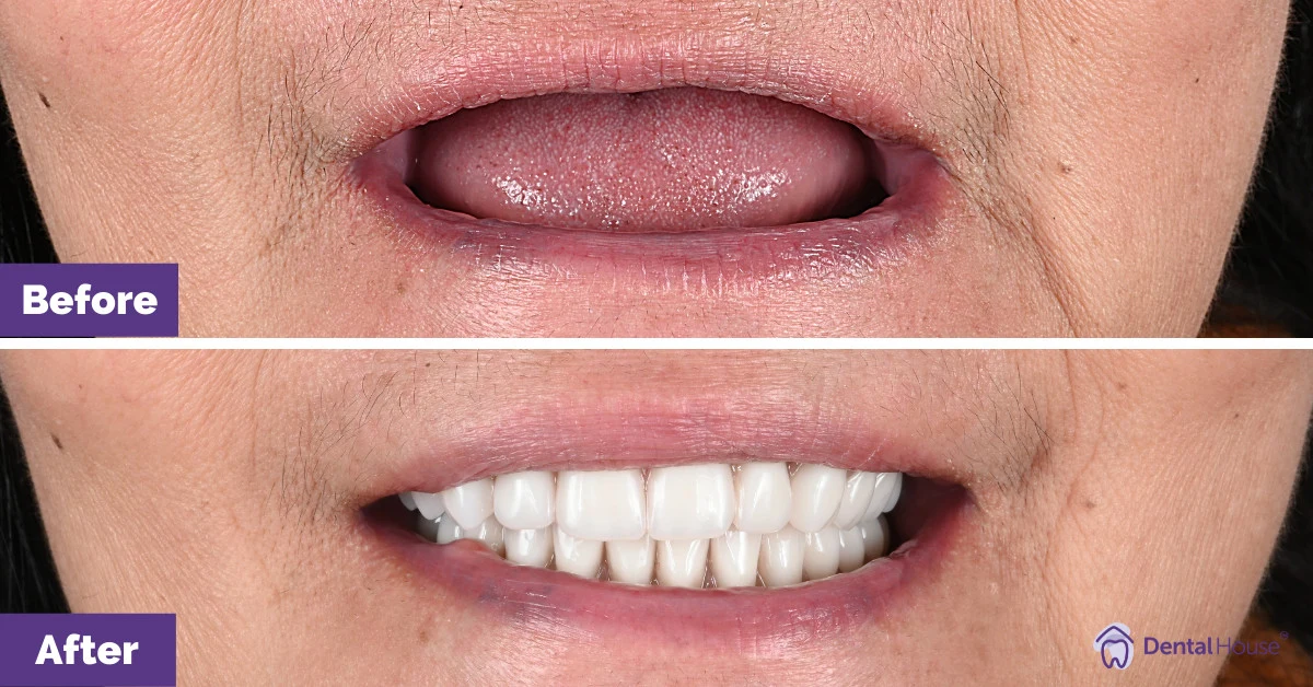 J’s Smile Makeover in Sunbury Gallery image