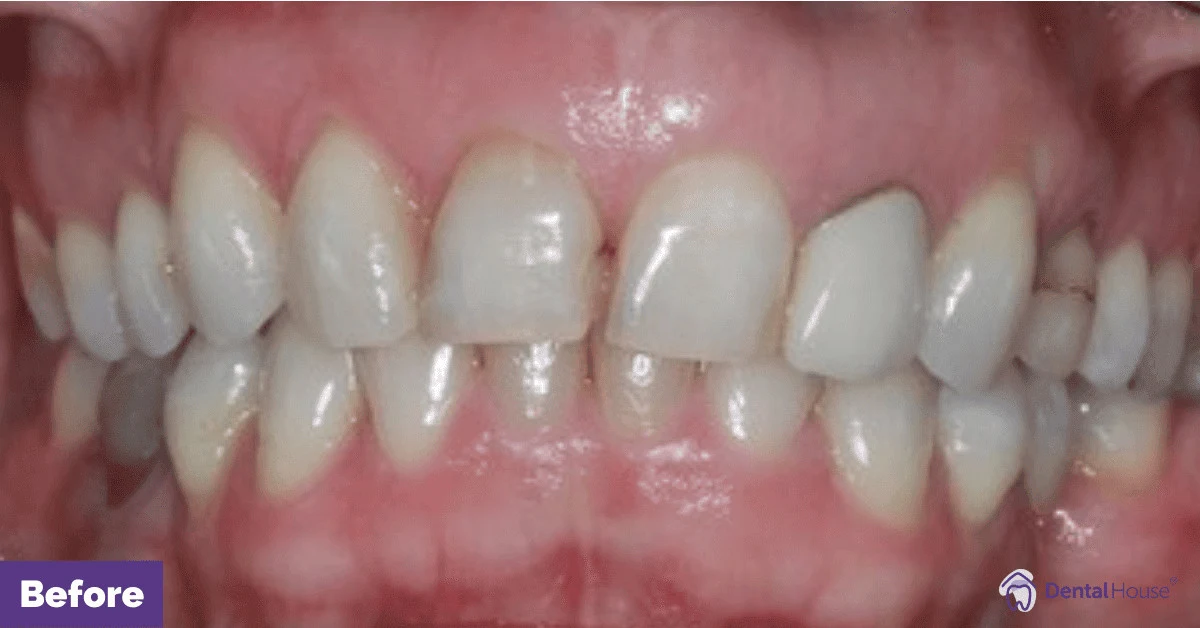 JM’s Porcelain Veneers & Whitening in Gisborne Gallery image
