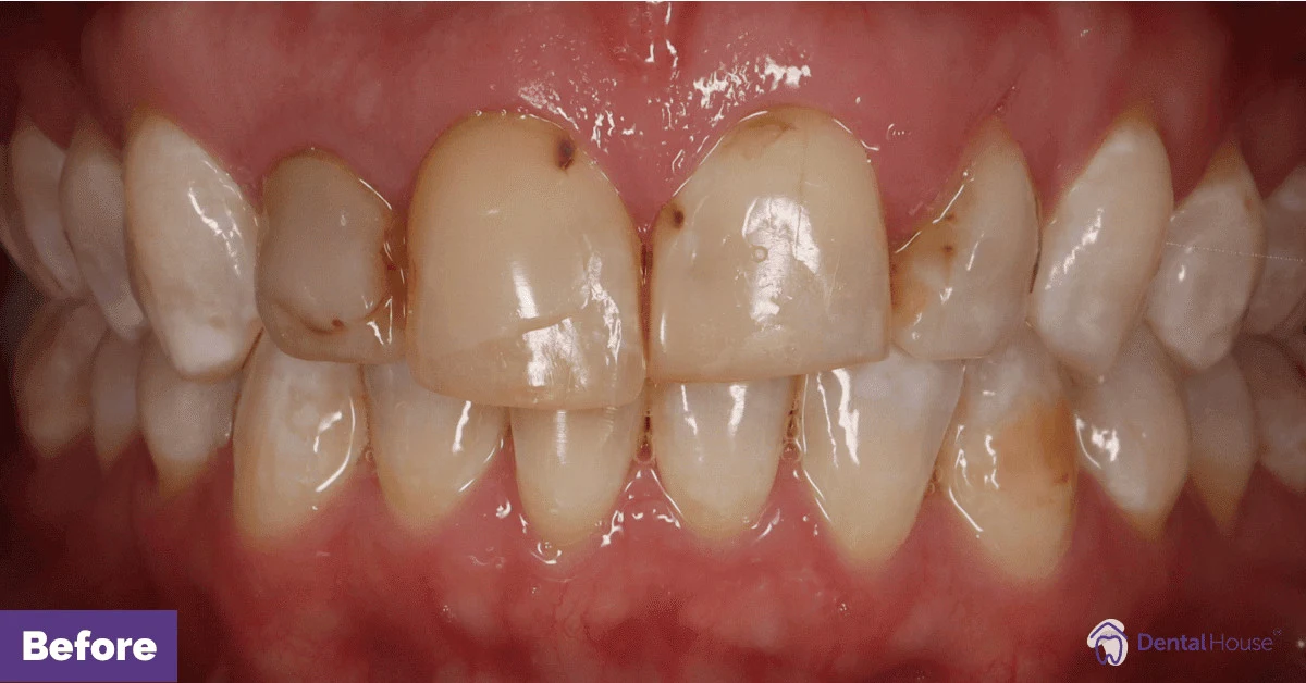Kerry’s Smile Makeover in Bacchus Marsh Gallery image