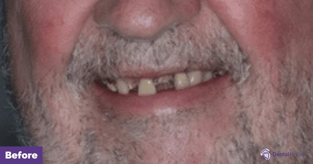 RN’s Smile Makeover in Gisborne Gallery image