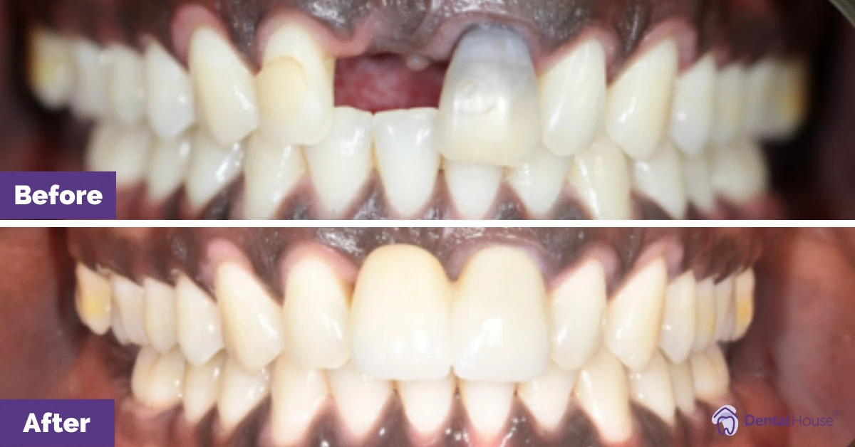 Riak’s Smile Make over in Sunbury Gallery image