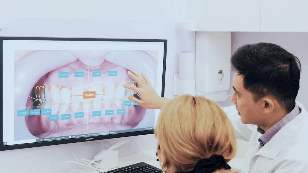 What Is The Process Of Dental Veneers? What is the Process of Dental Veneers Updated 1